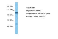 SAPS2 Antibody, Novus Biologicals 100 &mu;L; Unconjugated:Antibodies, Polyclonal